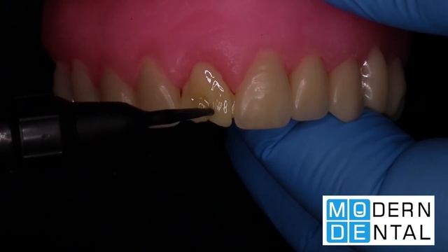 მერილენდის ხიდი-Meryland Bridge - Modern Dental 24/7 смотреть онлайн