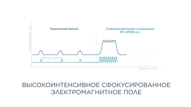 BTL Emsella market release video RU смотреть онлайн