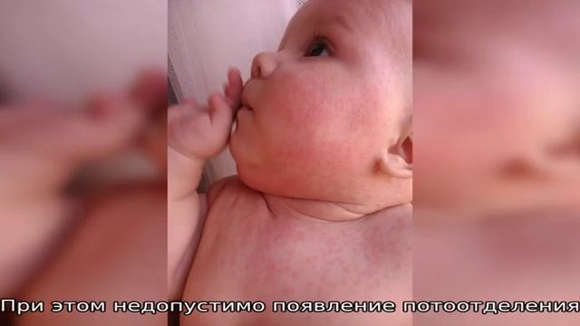Как отличить потницу на лице у ребенка от аллергии: описание признаков, фото. Как избавиться от по. смотреть онлайн