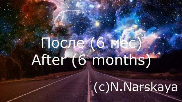 До и после занятий вокалом. Before and after singing lessons смотреть онлайн