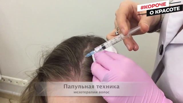 Мезотерапия против выпадения волос! смотреть онлайн