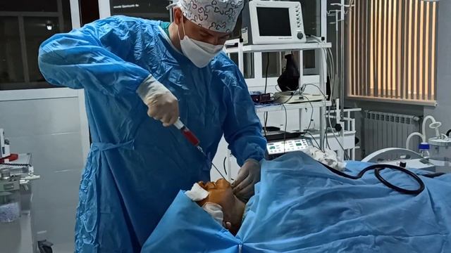 Шприцевая липосакция лица и шеи