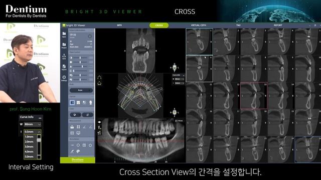 [Dentium] CT Viewer_bright 3D Viewer Manual_Cross
