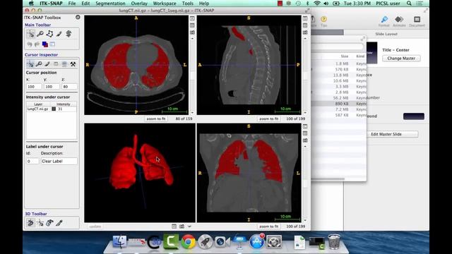 ITK-SNAP 3.2 User Training, Session 8: 3D Navigation and Editing смотреть онлайн