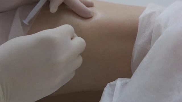 склеротерапия вен на ногах смотреть онлайн