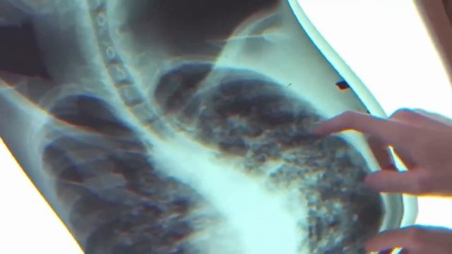 Экадаши. Аутофагия. Голодание. смотреть онлайн