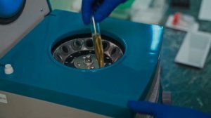 Как происходит общий анализ мочи