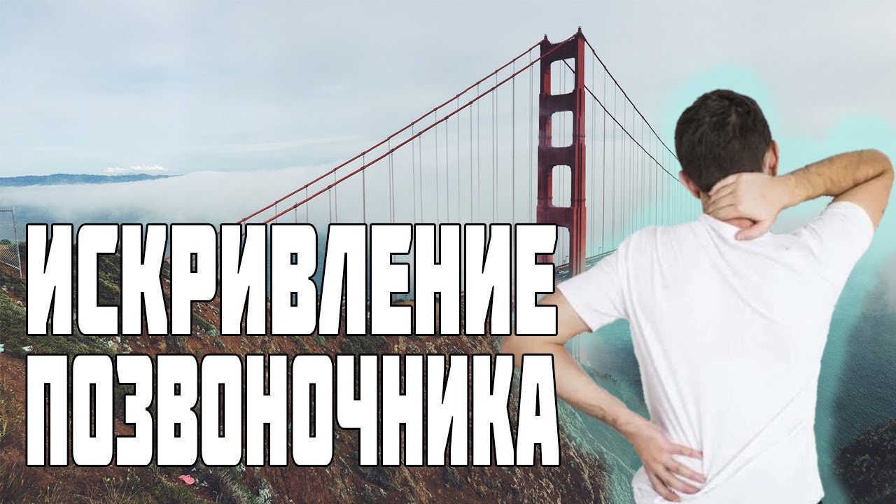 Искривление позвоночника (сколиоз лордоз кифоз), как исправить?