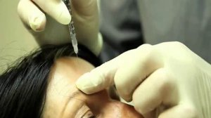 Инъекции Ботокса или ботулотоксина - Техника и результаты