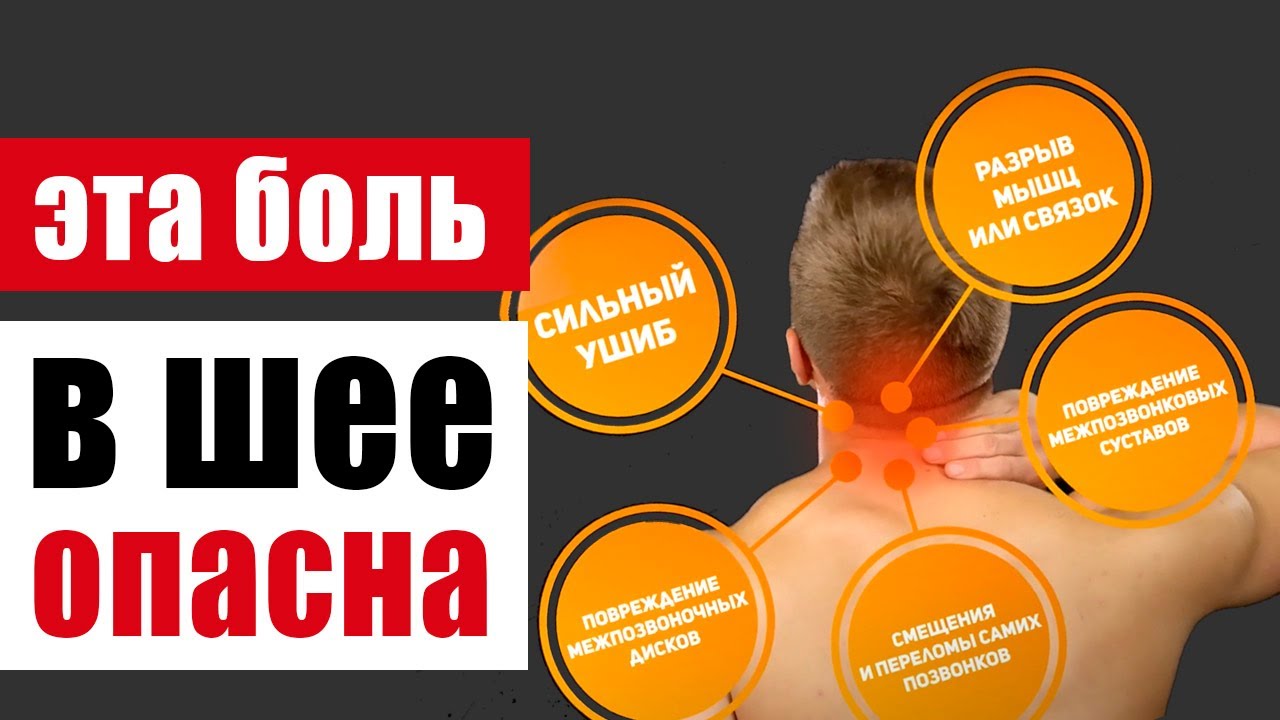Болит шея. Какие опасности скрывает боль в шее? смотреть онлайн