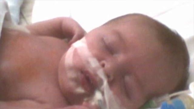 30 лет детской кардиохирургии СПб: история и современность. смотреть онлайн