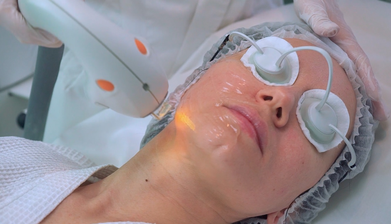 Фототерапия на аппарате Lumenis M22 смотреть онлайн