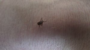 20 КЛЕЩЕЙ НА СЕБЕ! Несколько ВПИЛОСЬ! Клещи эксперимент!