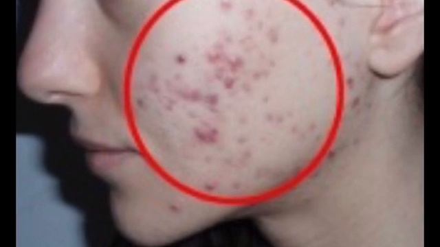 угри смотреть онлайн