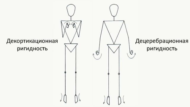 Методика неврологического осмотра. Часть XXV смотреть онлайн