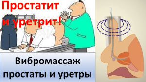 Вибромассаж простаты и уретры