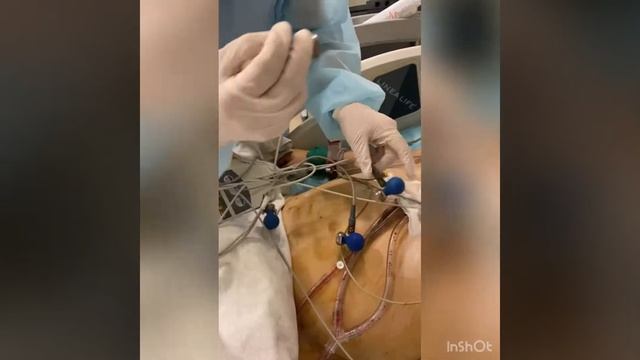 ЭКГ-электрокардиограмма