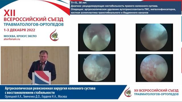 Артроскопическая ревизионная хирургия коленного сустава с восстановлением стабильностиОрлецкий А.К смотреть онлайн