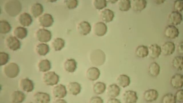 Кровь человека из раны смотреть онлайн