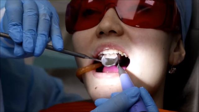 Профессиональная чистка зубов AirFlow смотреть онлайн