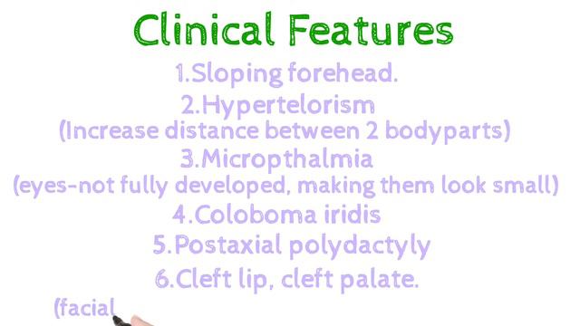 Patau Syndrome#Trisomy13#Anatomy#Genetics#Autosomalabnormalities смотреть онлайн