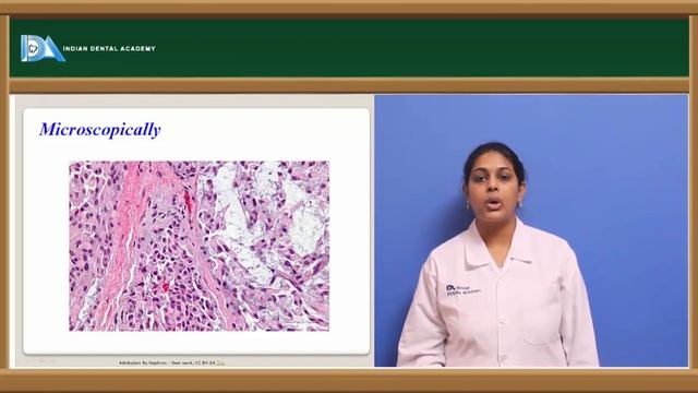 Diseases of salivary glands | General Pathology | Indian Dental Academy смотреть онлайн