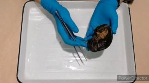 Топография и строение селезёнки