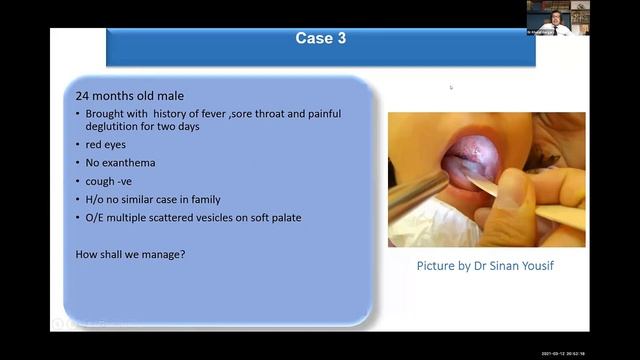 Pediatric Infection Live Webinar смотреть онлайн