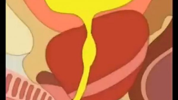 Простатит-механизм возникновения