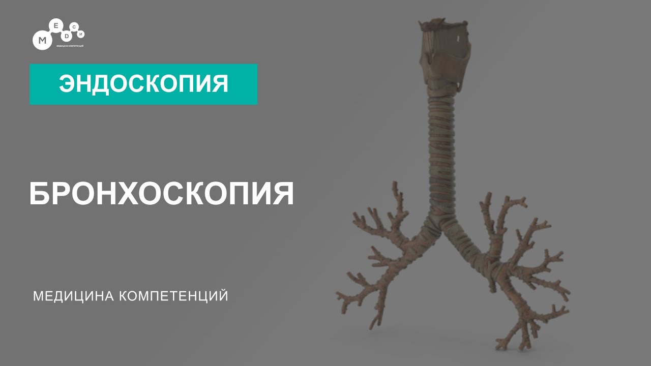 Бронхоскопия // Подготовка перед бронхоскопией // Когда назначают бронхоскопию смотреть онлайн