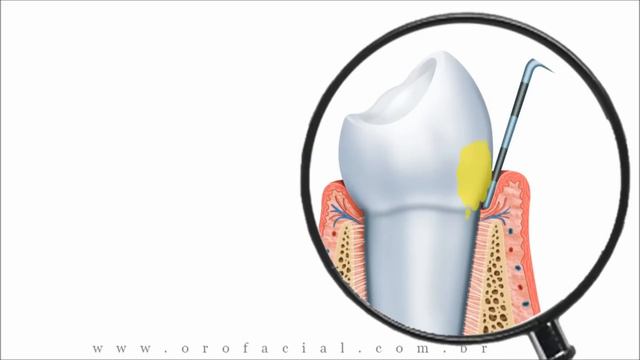 Gengiva смотреть онлайн