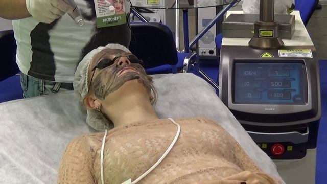 Карбоновый пилинг Helios II смотреть онлайн