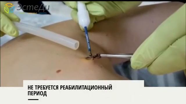 15 ноября 2017 г. смотреть онлайн