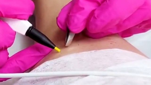 Электролог - новая высокооплачиваемая профессия. Курсы электроэпиляции с дипломом от Академии 21 смотреть онлайн