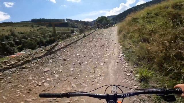 THIS IS WHY GREENHILL BIKE PARK IS THE BEST - ALL BIKE PARKS NEED THIS!! смотреть онлайн