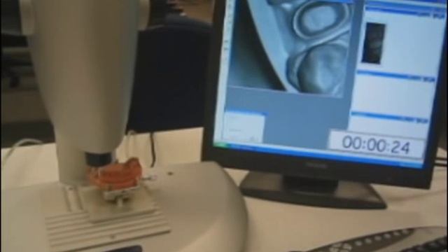 inEos Dental Digitizer Fast.mpg смотреть онлайн