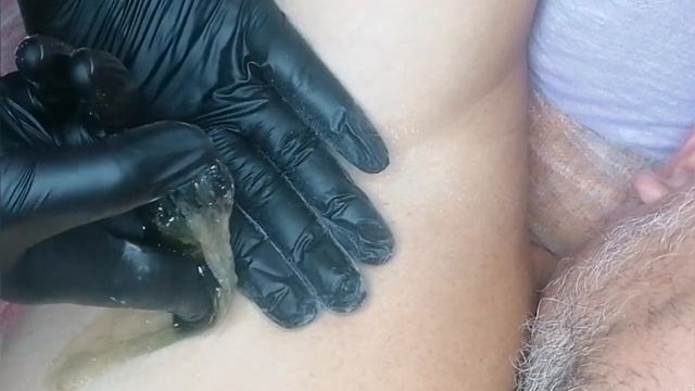 Мужской Шугаринг. Удаление Волос на Подмышках. смотреть онлайн