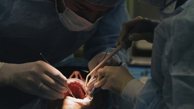 Имплантация зубов. Установка Имплантов..mp4