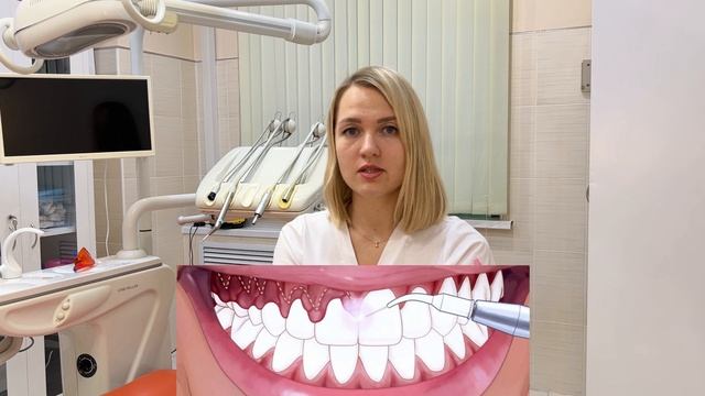 ? Как убрать десневую улыбку? И что такое гингивэктомия? смотреть онлайн