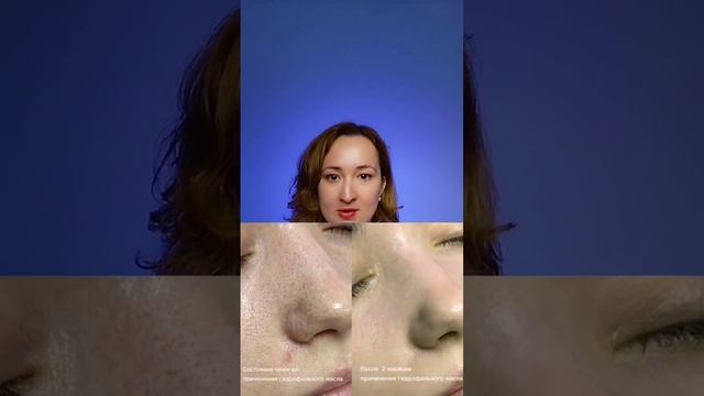 СКАЖИ НЕТ ПРЫЩАМ И ПОКРАСНЕНИЯМ!Гидрофильное масло (Atomy Deep Pure Cleansing Oil)ПОМОЖЕТ ТЕБЕ смотреть онлайн