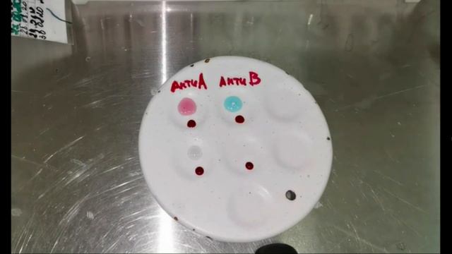 совместимость крови донора и реципиента смотреть онлайн