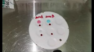 совместимость крови донора и реципиента