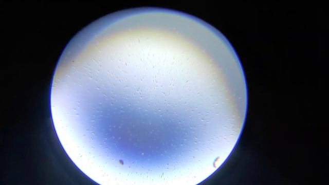 Шкурка яйца,желток,сопли, дрожжи и ноготь под микроскопом ?