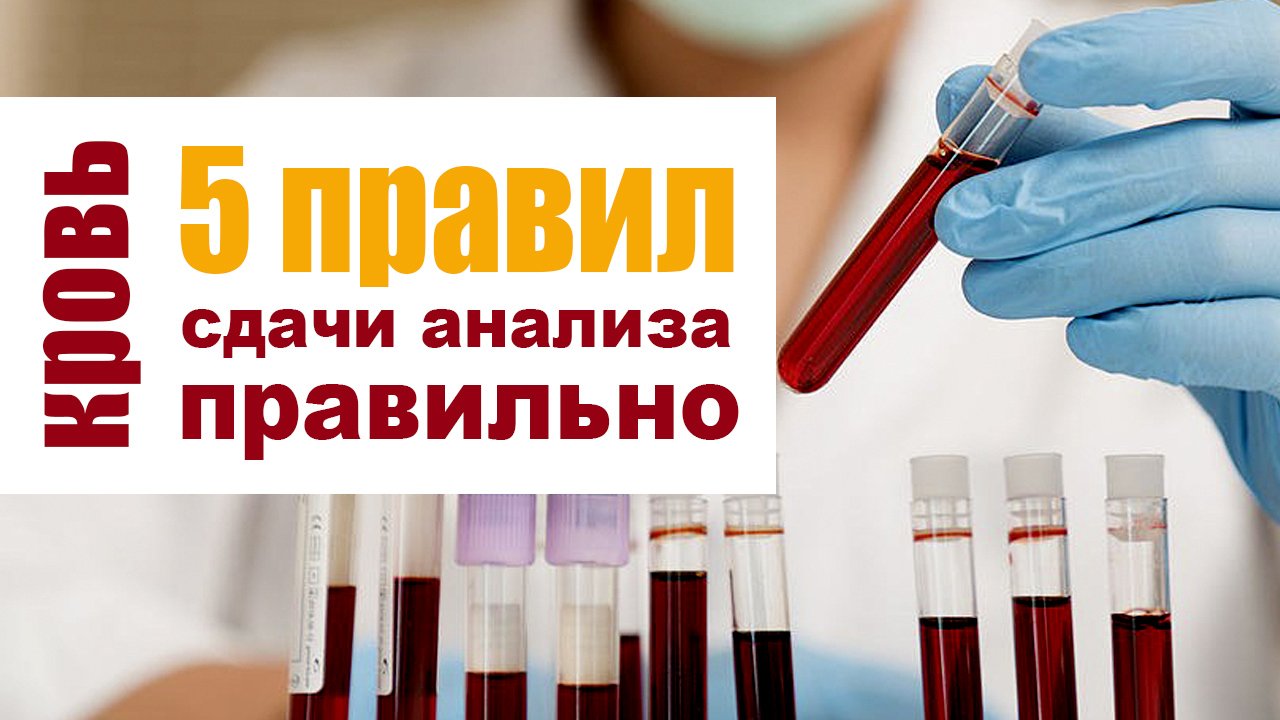 5 правил подготовки к биохимическому анализу крови смотреть онлайн