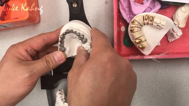 How to Make a Full-Mouth, Metal, Ceramic Restoration смотреть онлайн
