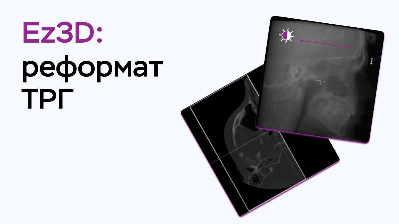 Возможности программы Ez3D: реформат ТРГ смотреть онлайн