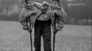 Советские СИАМСКИЕ близнецы: Маша и Даша Кривошляповы. СУДЬБА ДВУХ СЕСТЕР