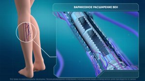 Графический ролик