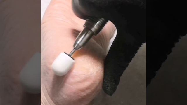 Абразивные колпачки для педикюра MedCaps смотреть онлайн