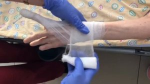 Спиральная повязка на палец